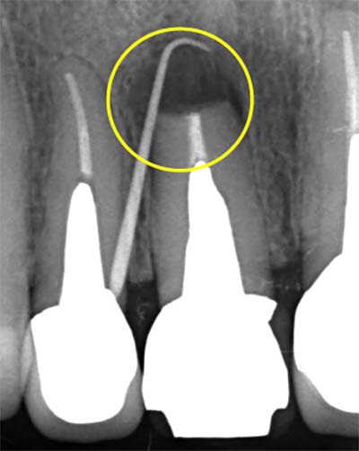 初診時（腫脹が認められる）