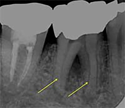 初診時（術前）