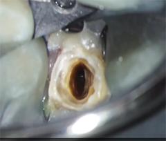 マイクロスコープ