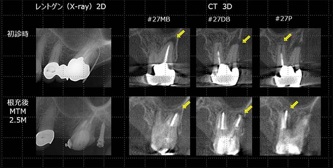 当院での治療例