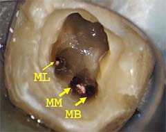 マイクロスコープによる拡大視野