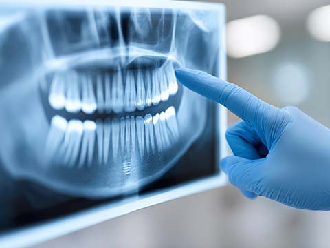 3Dで骨と周囲解剖を詳細に把握