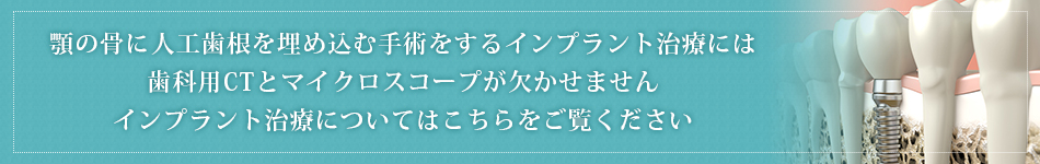 顎の骨に人工歯根を埋め込む手術をするインプラント治療には歯科用CTとマイクロスコープが欠かせませんインプラント治療についてはこちらをご覧ください